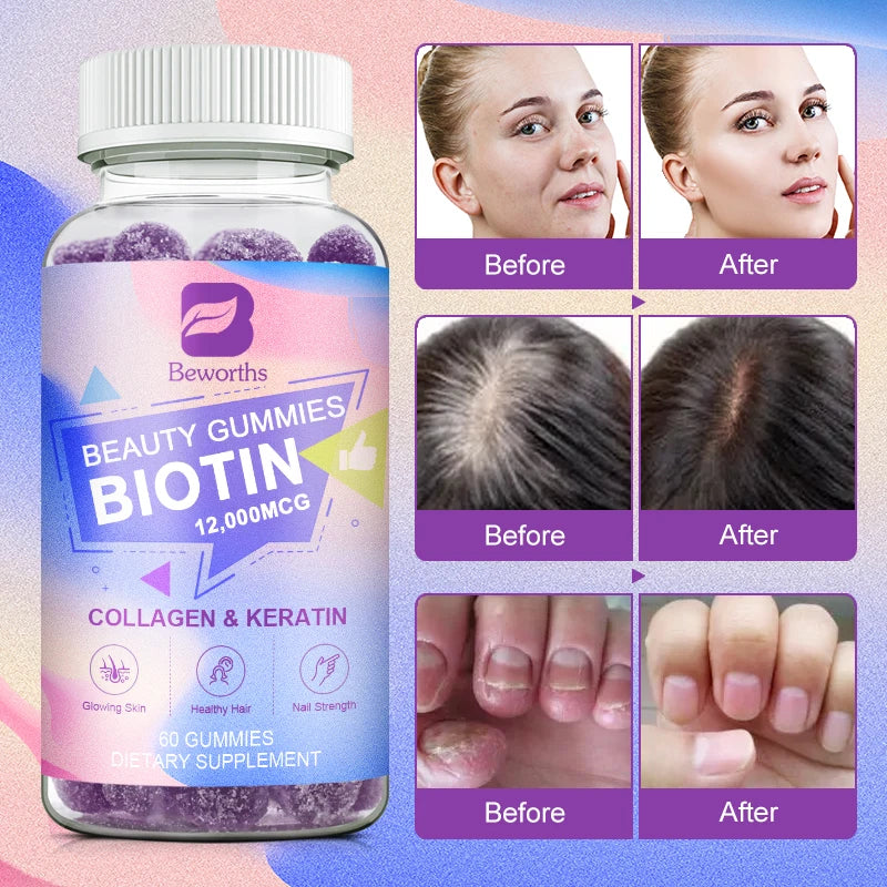 Biotin Beauty Gummies